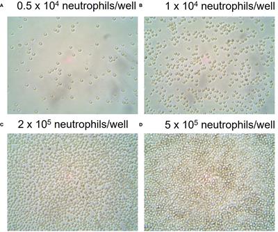 Real-time assessment of neutrophil metabolism and oxidative burst using extracellular flux analysis